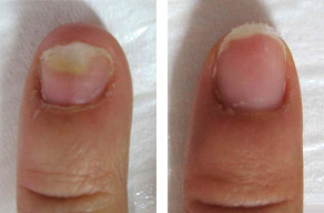 hand before and after